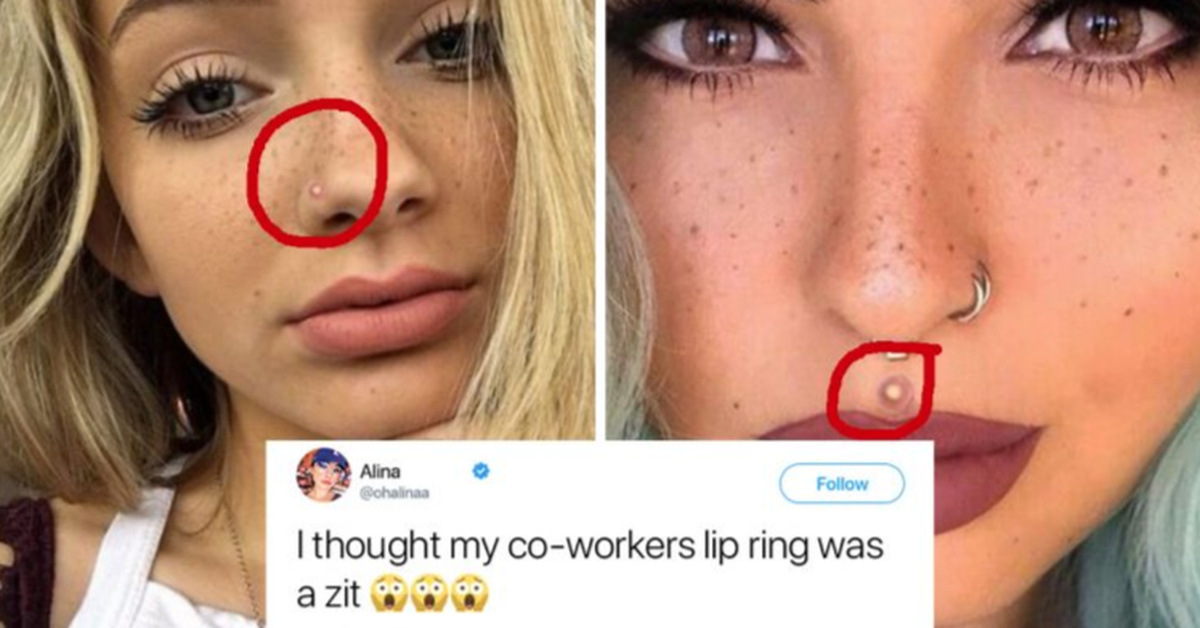 Zit Rings Are The Newest And Hottest Fashion Trend To Hide Your