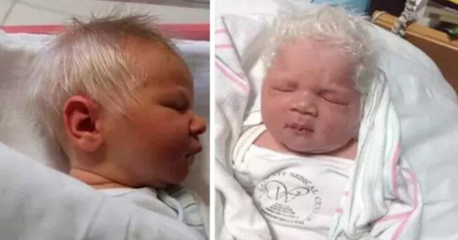 Baby Bence Born With White Hair Archives Inner Strength Zone