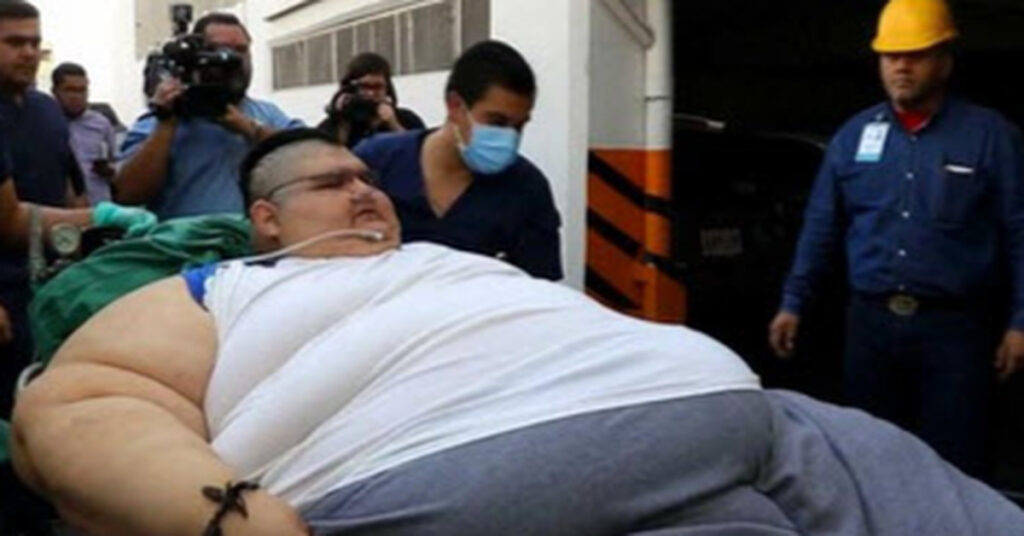 The Fattest Man In The World Is Walking For The First Time In A Decade 