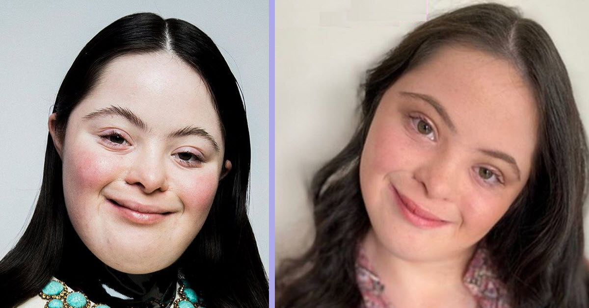 18-Year-Old Model Doesn’t Let Down Syndrome Stop Her When She Nails It ...