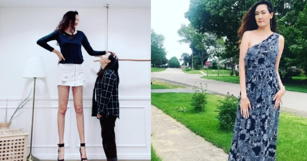 Woman Possessing World’s 2nd Longest Pair of Legs Isn’t Shy About ...